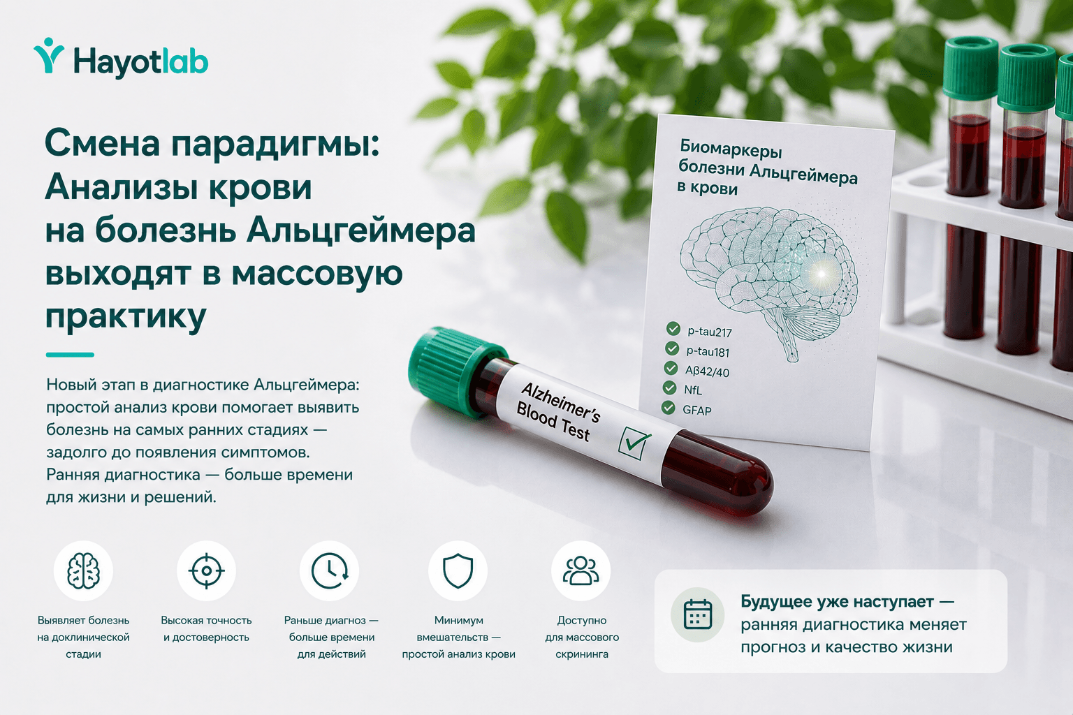 Смена парадигмы: Анализы крови на болезнь Альцгеймера выходят в массовую практику